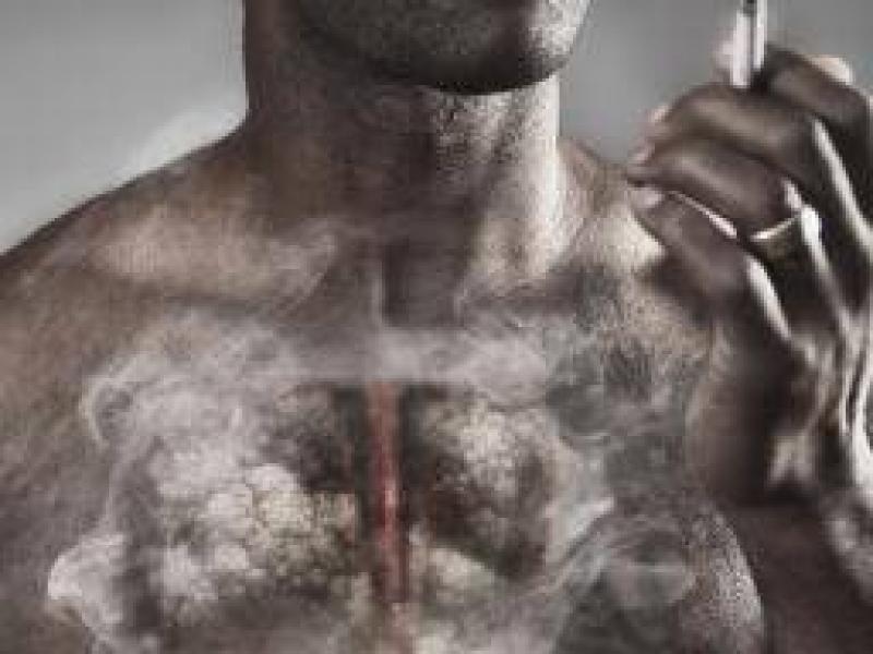 Amfizem: Belirtileri, tedavisi ve nedenleri