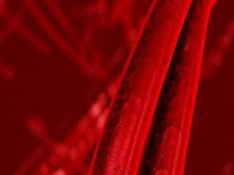 Demir fazlalığı belirtileri, nedenleri ve tedavisi