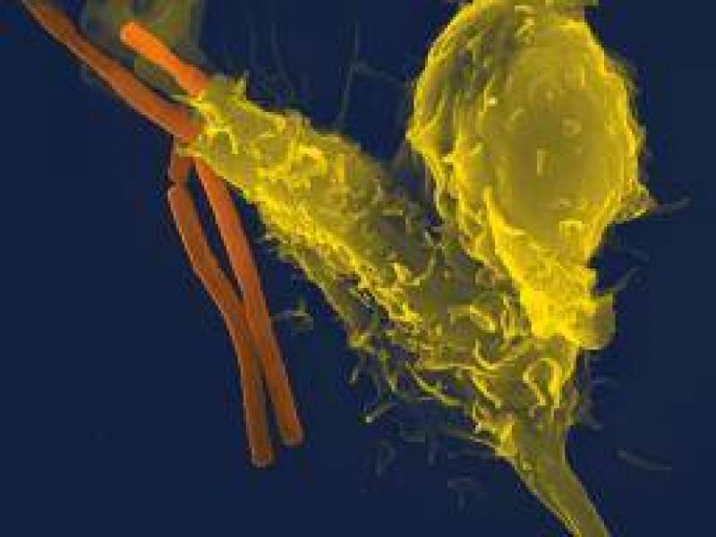 Bağışıklık sistemi, Hücreler, dokular, fonksiyonlar ve hastalıklar