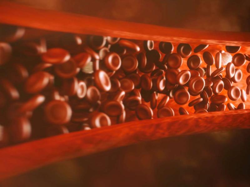 Septisemi risk faktörleri, belirtileri, tedavisi ve iyileşme