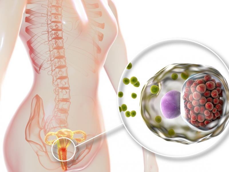 Klamidyanın belirtileri, tedavisi ve nedenleri